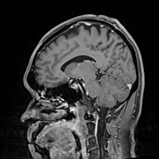 Click on the Serie image to view the images of VILLANUEVA, WILLIAM A.